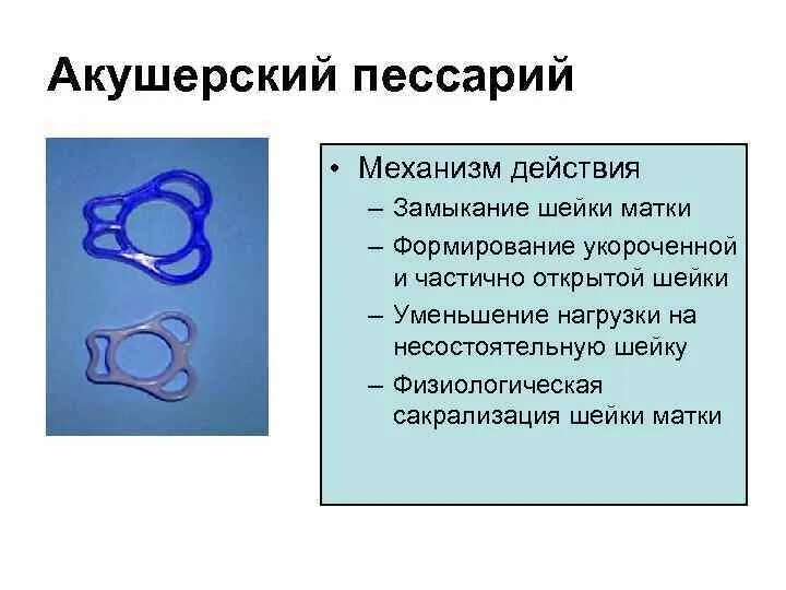 После снятия пессария через сколько. Акушерский пессарий. Акушерское кольцо пессарий. Что такое пессарий при беременности. Кольцо при беременности.