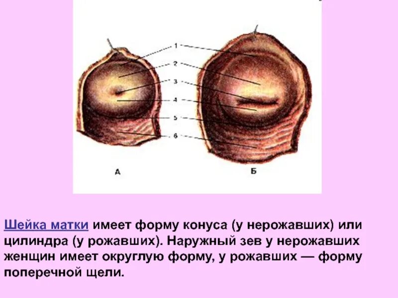 Маточный зев. Форма шейки матки нерожавшей женщины. Коническая и цилиндрическая форма матки. Коническая форма шейки матки нерожавшей женщины. Форма шейки матки и наружного зева у нерожавших.