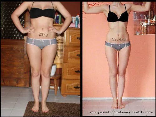Минус 10 кг до и после. Модельная диета до и после. Минус 5 килограмм до и после. Минус 5 кг до после. 45 кг 10 н