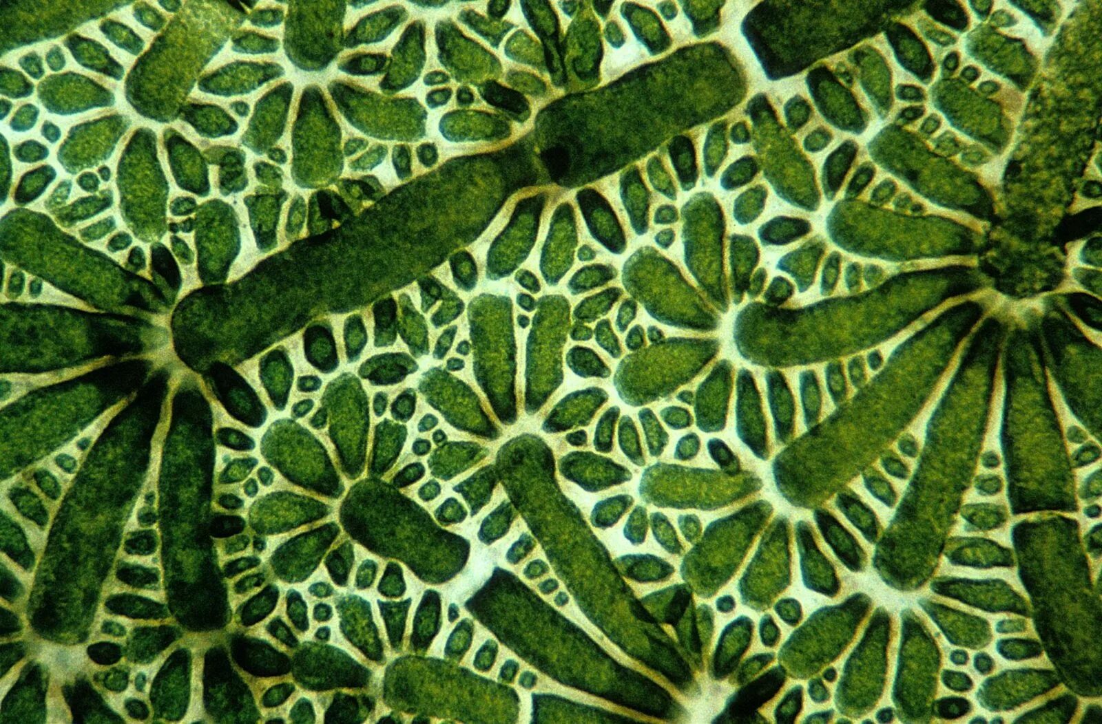 Клетки алоэ. Ткань папоротниковых растений под микроскопом. Элодея срез. Клетки растений под микроскопом. Лист растения под микроскопом.