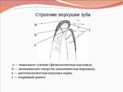 Связка верхушки зуба