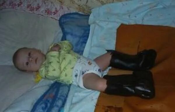 Парафин на ножки ребенку