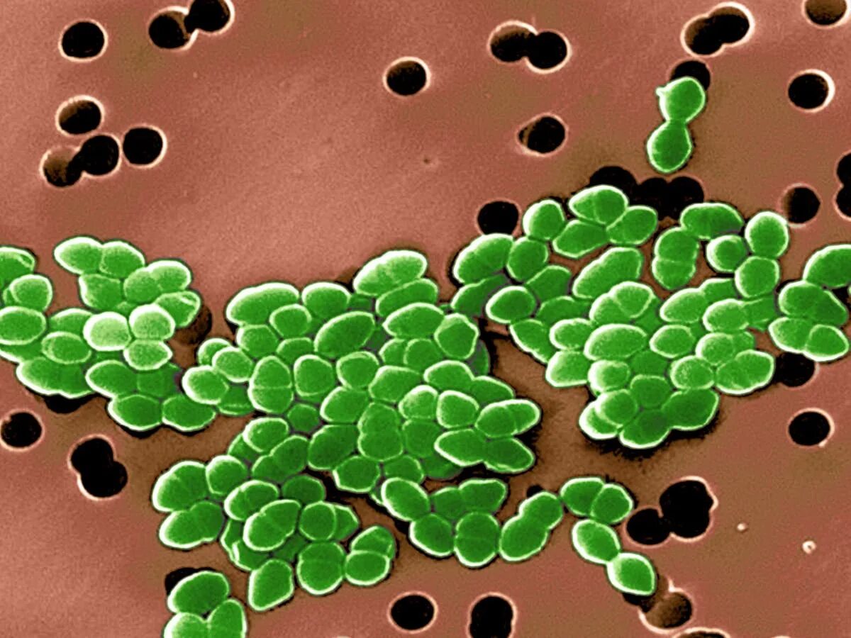 Enterococcus 10 в 5