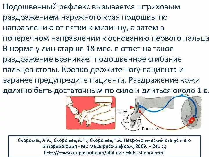 Как проверить рефлексы. Подошвенный рефлекс Бабинского схема. Подошвенный рефлекс Бабинского рефлекторная дуга. Схема рефлекторной дуги подошвенного рефлекса. Исследование подошвенного рефлекса.