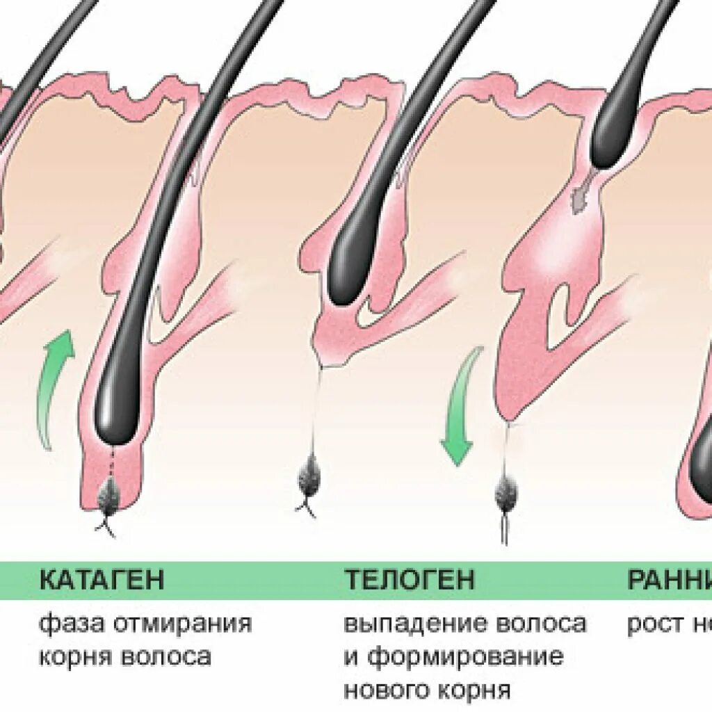 Анаген катаген телоген. Фазы роста волос анаген. Волосяная луковица. Этапы роста волос.
