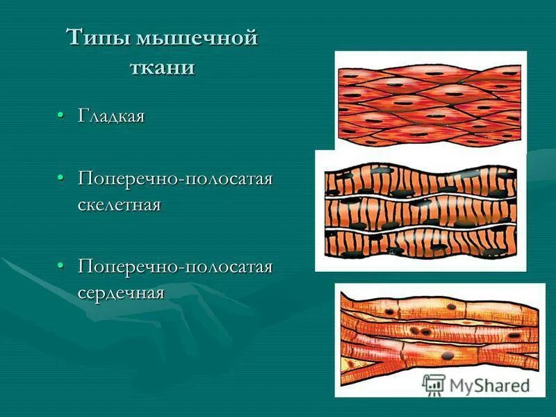 Сердечная мышца представлена поперечно полосатой. Скелетная мышечная ткань попере. поперечно-полосатая скелетная мышечная ткань. поперечнополосатая скелетная мышечная ткань строение. поперечно полосатая скелетная сердечная ткань.