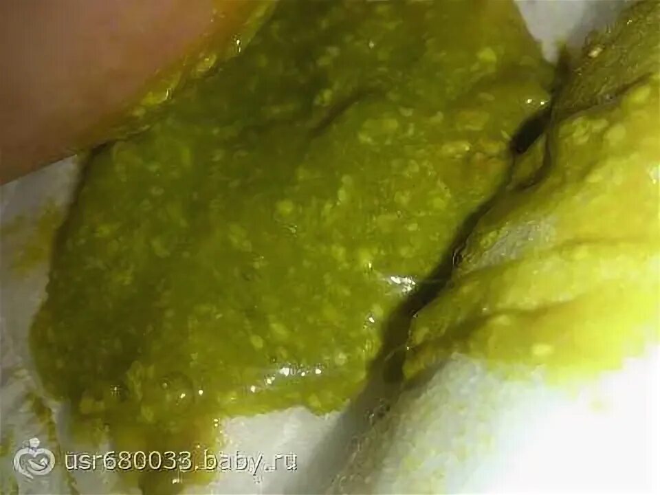 Грыжа рвота