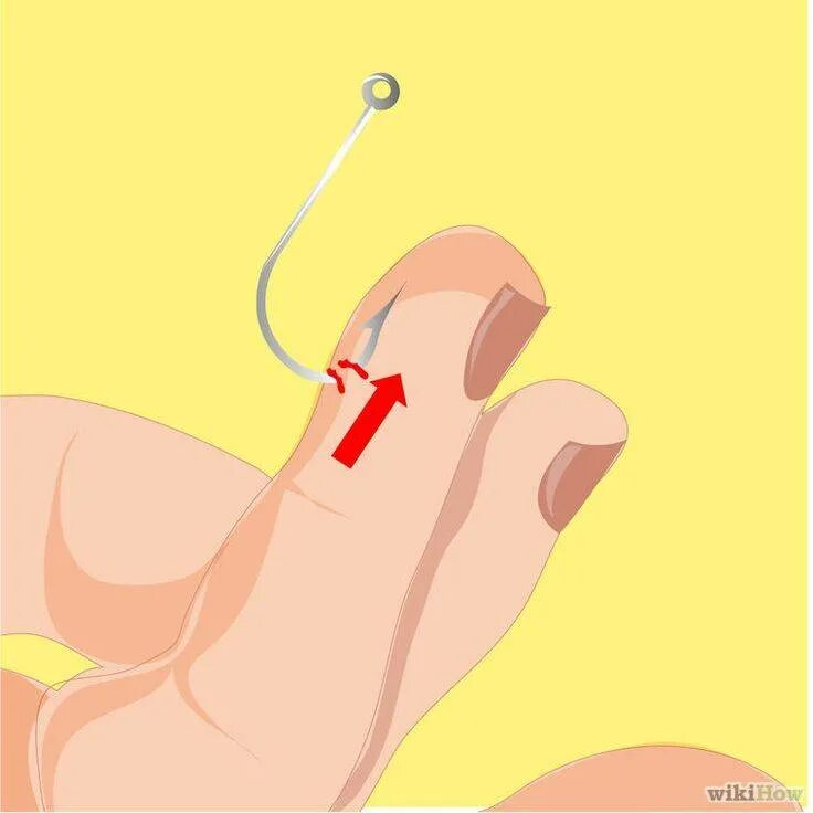 Как вытащить рыболовный крючок из пальца. Как вытащить рыболовный крючок из пальца. Как достать пальцем. Крючок воткнулся в палец. Если не вытащить занозу.