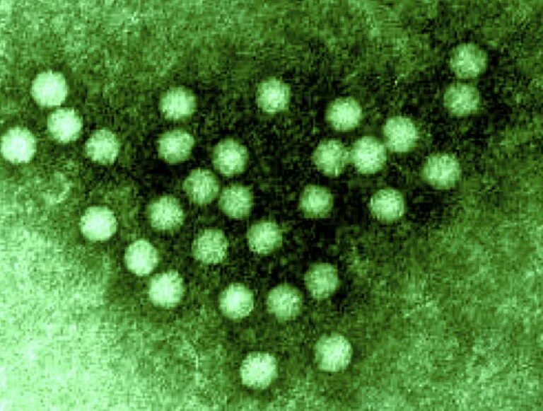 Вирус чумы плотоядных. Virus panleukopenia feline. панлейкопения возбудитель. возбудитель панлейкопении кошек. панлейкопения кошек вирус.
