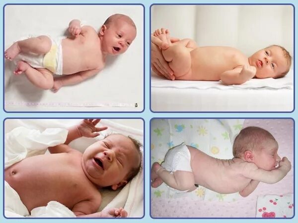 Тонус у месячного ребенка. Тонус мышц шеи у новорожденных 1 месяц. гипертонус мышц у новорожденных. гипертонус мышц новорожденного.