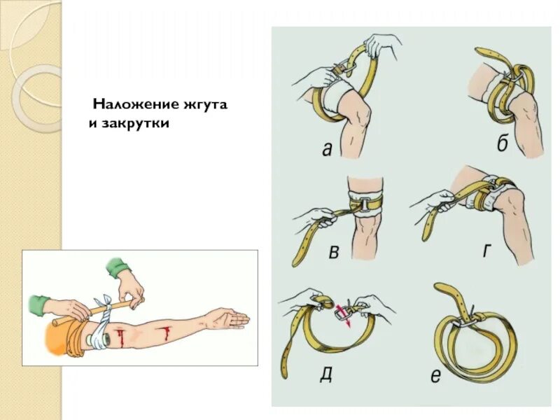 Алгоритм наложения жгута при артериальном кровотечении. Наложение жгута закрутки. Жгут-закрутка алгоритм наложение жгута. Техника наложения жгута закрутки алгоритм. Схема наложение жгута при кровотечении.