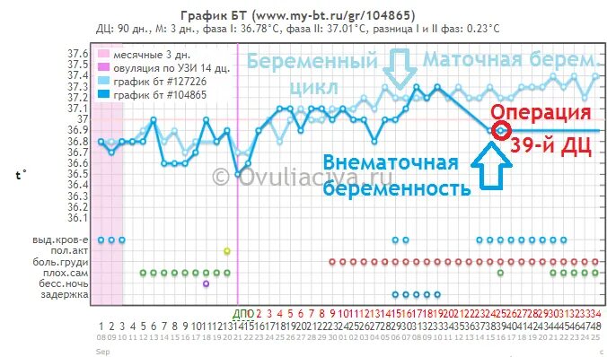 График базальной температуры при беременности после задержки. График БТ многоплодной беременности. График БТ при беременности на ранних сроках график. График БТ при беременности с низкой температурой до задержки. Какая базальная температура при беременности до задержки