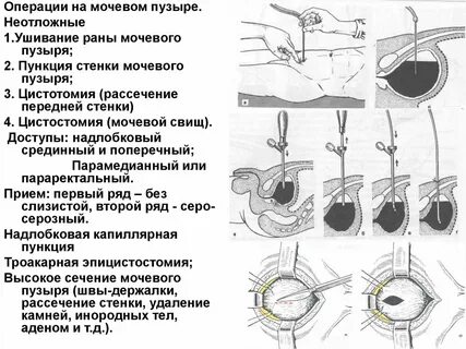 Простаты краснодара