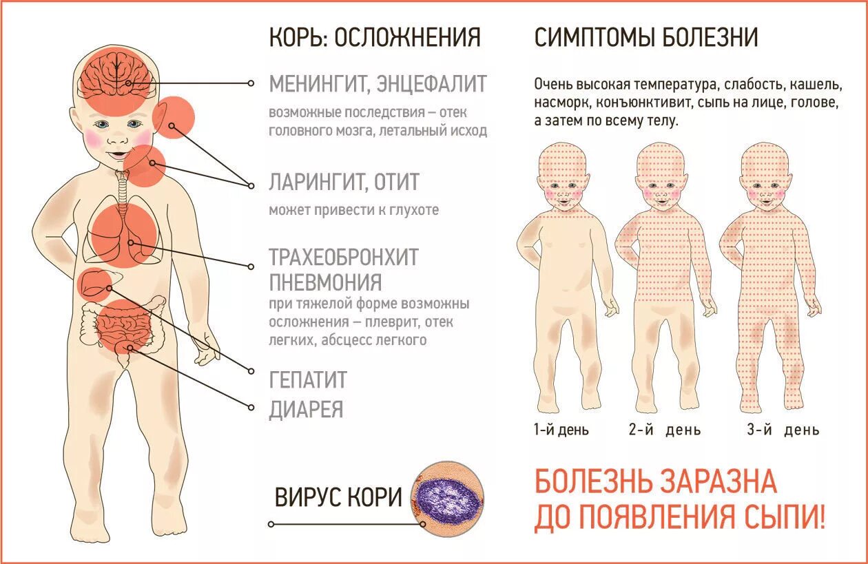 Какое лечение при кори