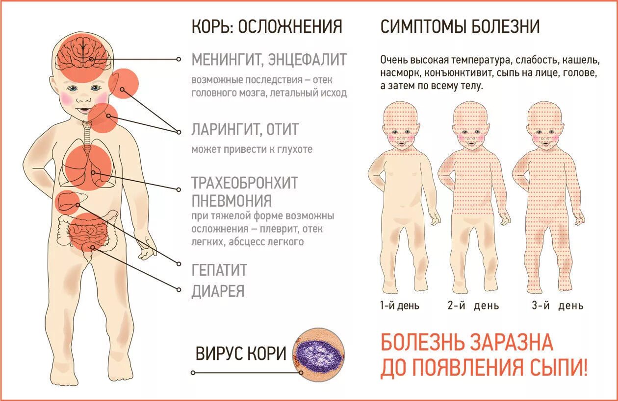 Сколько лечится корь