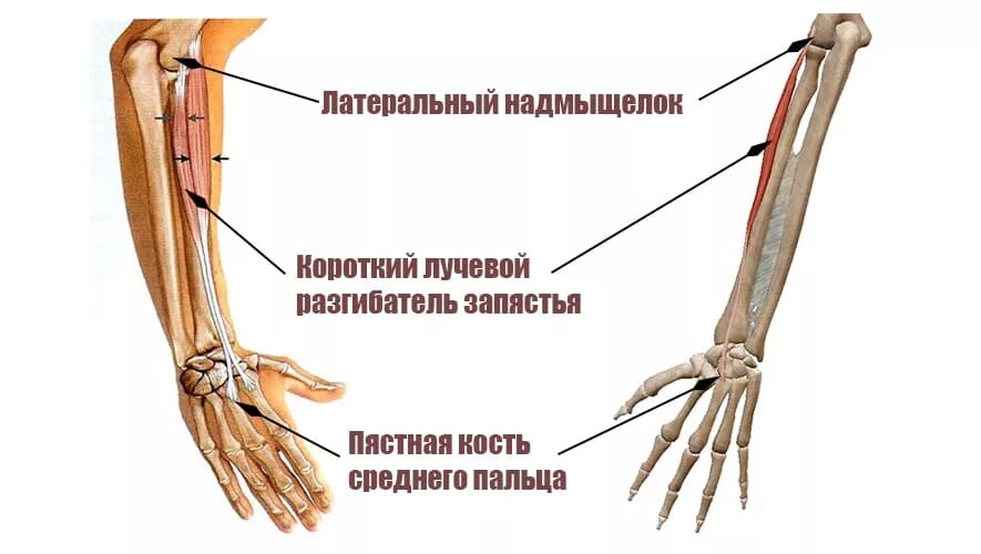 Связки на руке. Лучевой разгибатель запястья. Длинный и короткий лучевой разгибатель кисти. Короткий разгибатель запястья. Короткий лучевой разгибатель кисти.