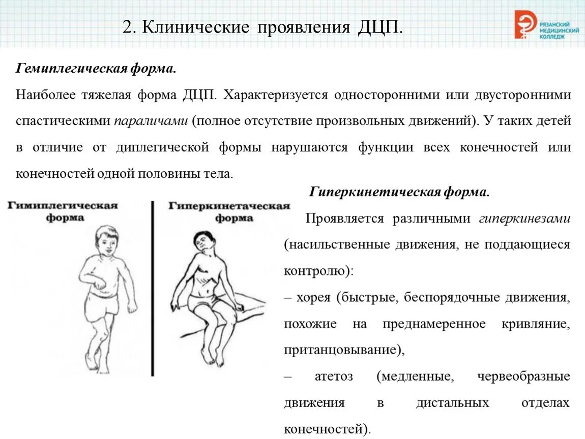 Гемиплегическая форма ДЦП характеристика. Клинические проявления ДЦП. Основные клинические проявления ДЦП. Проявления детский церебральный паралич.