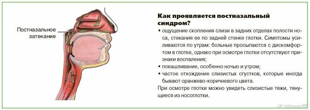 Ощущения слизи. Постринальный синдром. образование слизи в гортани.