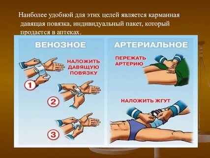 Способ остановки кровотечения наложение давящей повязки