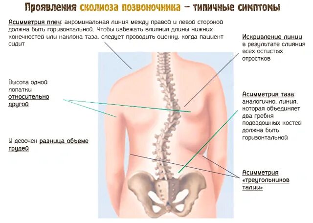 Боль в спине трудно дышать. Боли в спине причины. Боль в спине при вдохе. При вдохе болит поясница справа. На вдохе болит спина.