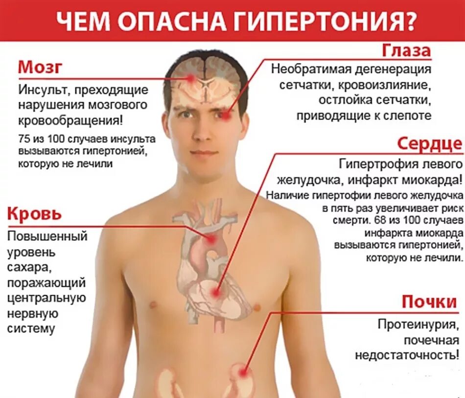 У больного давление. Гипертония. Артериальная гипертония симптомы. Симптомы АГ. Гипертоническая болезнь симптомы.