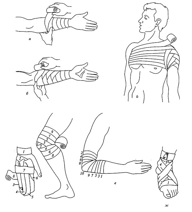 Как перебинтовать эластичным. Десмургия бинтовые повязки. Десмургия наложение повязок на Верхние и нижние конечности. Повязка на кисть десмургия. Техника бинтования десмургия.