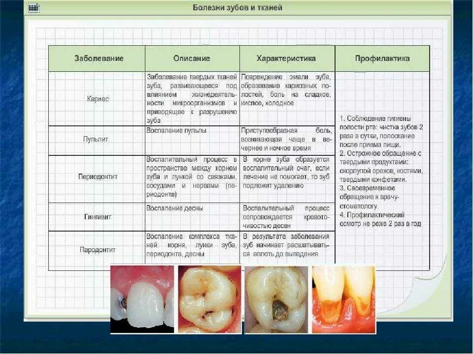 Функции тканей зубов. Заболевание зубов таблица. Таблица по заболевания зубов.