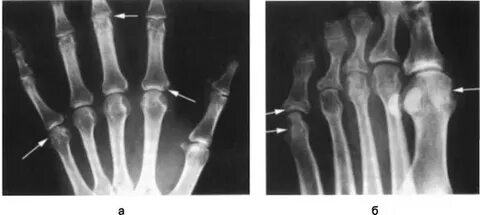 Бұлшық ет жігіттермен жыныстық қатынасқа қараңыз