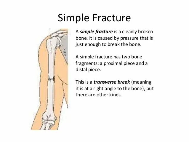 A fracture is a broken bone. Between fracture and formation pressure measurement.