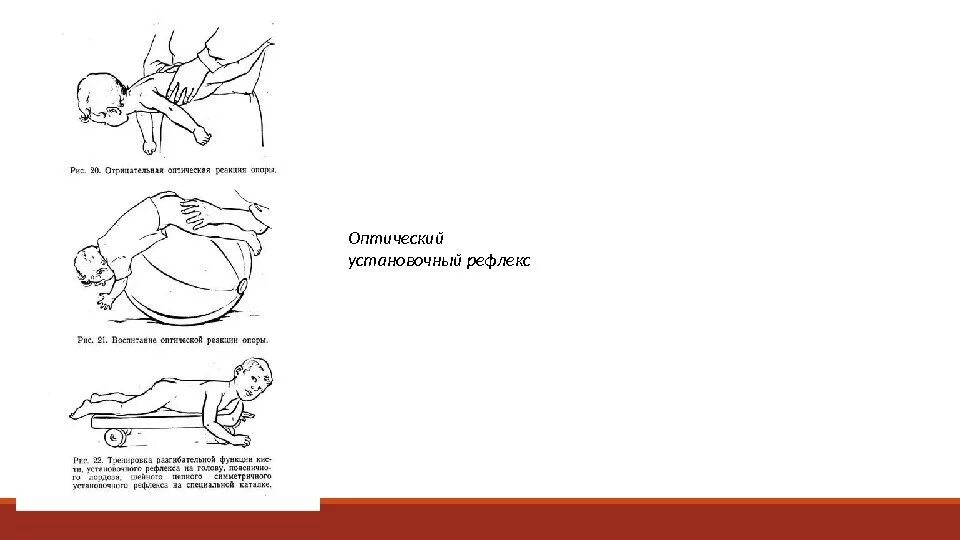 Рефлекс упражнение. Установочные рефлексы. Лабиринтный установочный рефлекс. Упражнение рефлексов. Рефлекторный уровень организации движений.