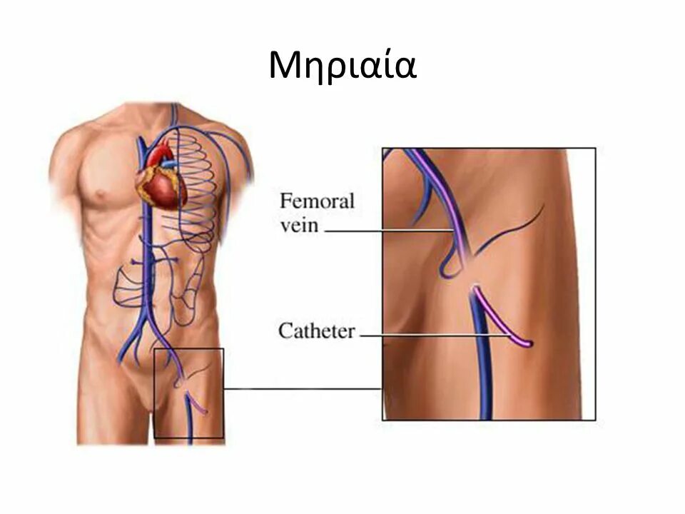 Вена в паху у мужчин. Бедренная Вена катетеризация ориентиры.