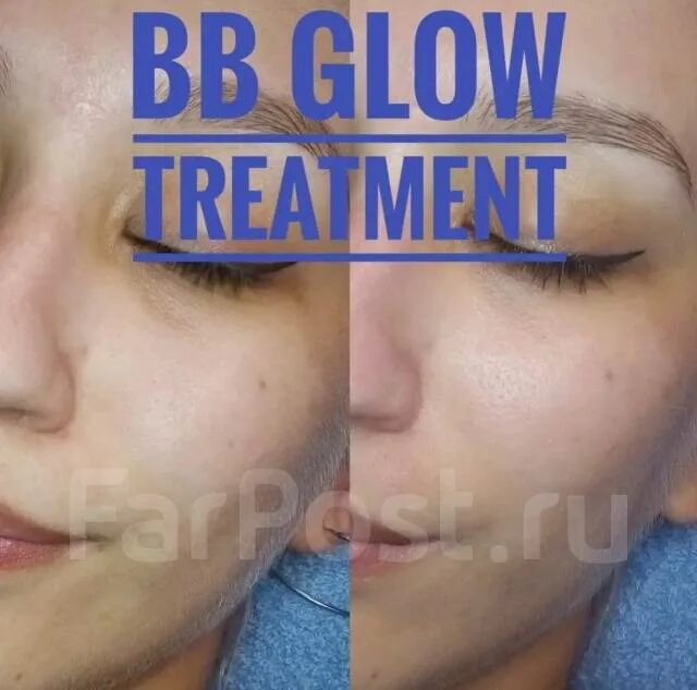 Крем с тональным эффектом. BB Glow эффект. ВВ Глоу эффект тонального крема. BB Glow treatment. Бб глоу