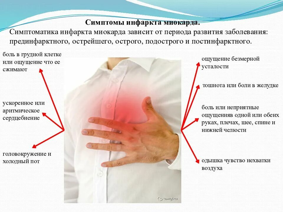 Причины боли сердца у мужчин. Инфаркт миокарда симптомы. Симптомы Инфакт миокарда. Симптомы инфаркта Биокад. Симптомы миокарда инфаркт миокарда.