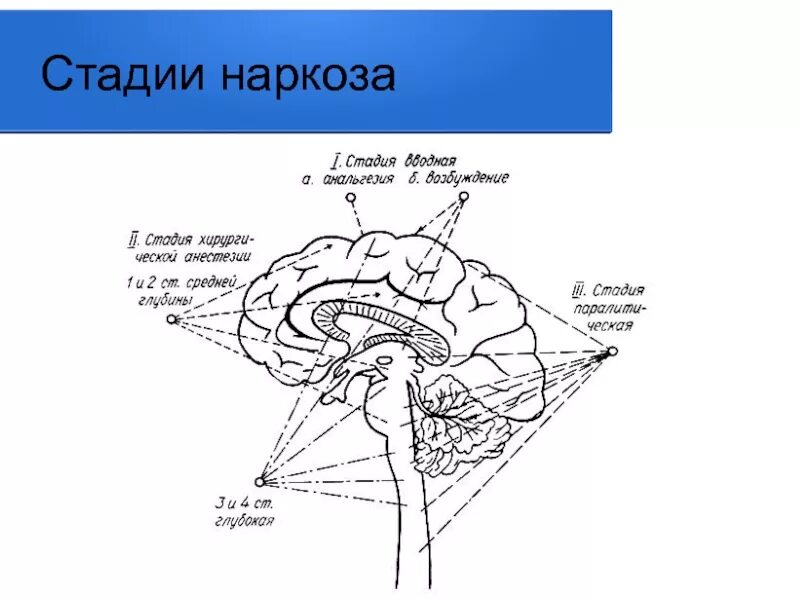 Этапы общей анестезии. Стадии общего наркоза. Стадии местной анестезии. Наркоз этапы наркоза. Стадии анестезии