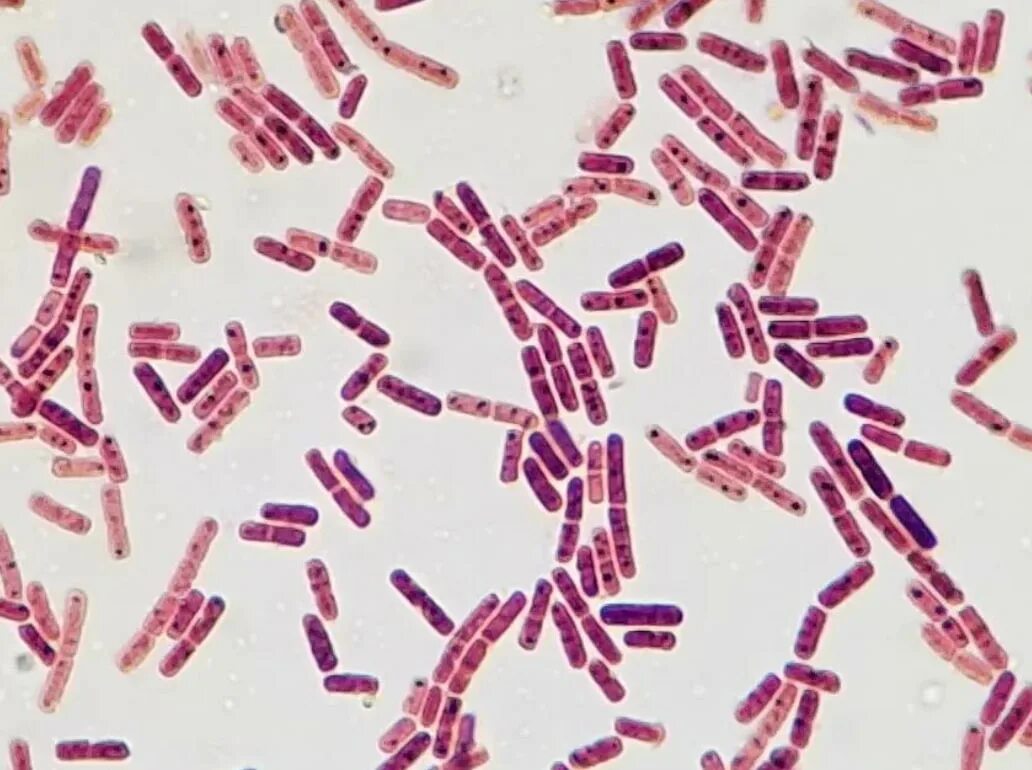 Coli sotwe. Эшерихии коли микроскопия. Escherichia coli по Граму. Эшерихия кишечная палочка. Эшерихия микроскопия.