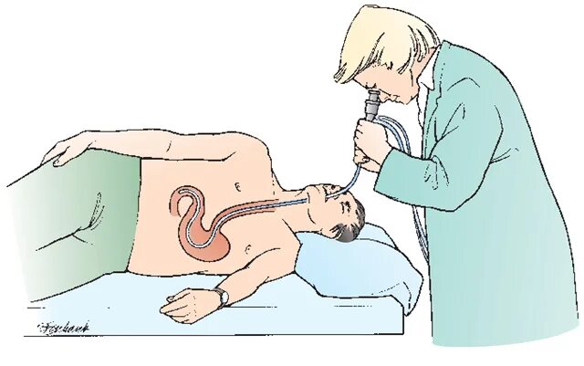 Зонд в кишечник. Гастроскопия желудка гастрит. Трубка для обследования желудка.