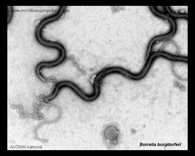 Borrelia burgdorferi