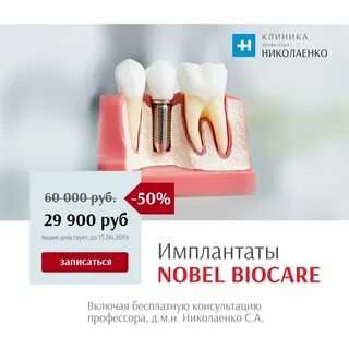 Импланты нобель отзывы