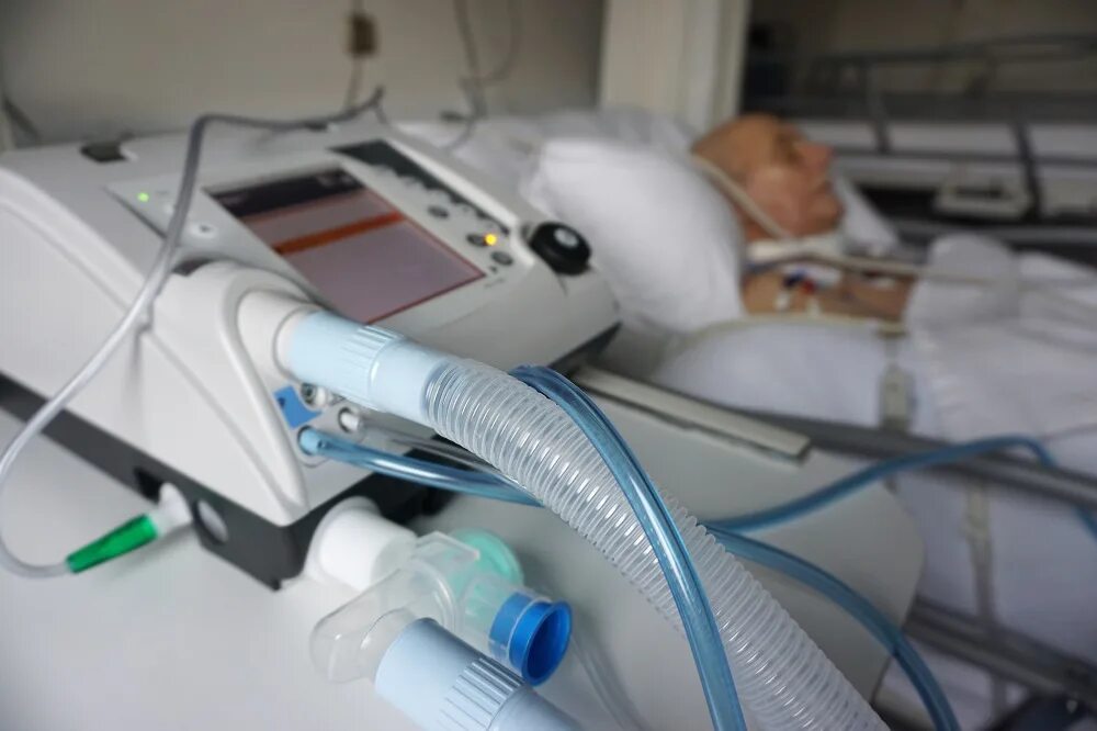 ИВЛ аппарат в реанимации. Дыхательный аппарат в реанимации. Дыхательный аппарат в больнице. Аппарат активной аспирации в реанимации.