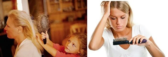 Почему после родов выпадают. Выпадают волосы после родов фото. после родов посыпались волосы. после рожовое выпадение волос фото форум. как остановить выпадение волос у женщин после родов.