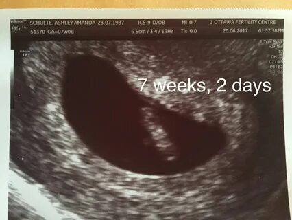 Week 7 days 2