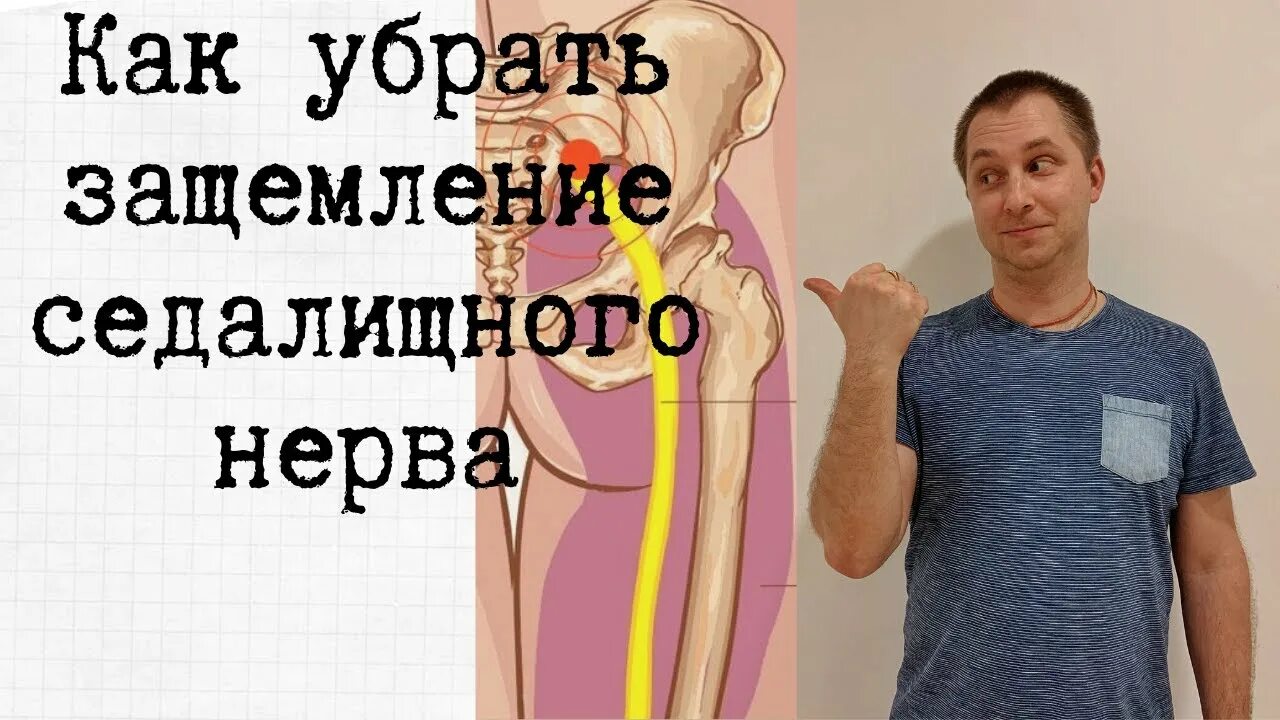 Защемление седалищного нерва симптомы отзывы. Пластырь от седалищного нерва. пластырь от защемления седалищного нерва. нано пластырь от болей седалищного нерва. куда клеить пластырь при защемлении седалищного нерва фото.