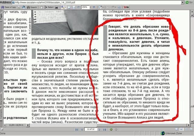 Какое обрезание делают девочке. Обрезание у женщин схема. обрезание у мужчин схема. обрезание у мужчин схема ислам. почему делается обрезание у мужчин.