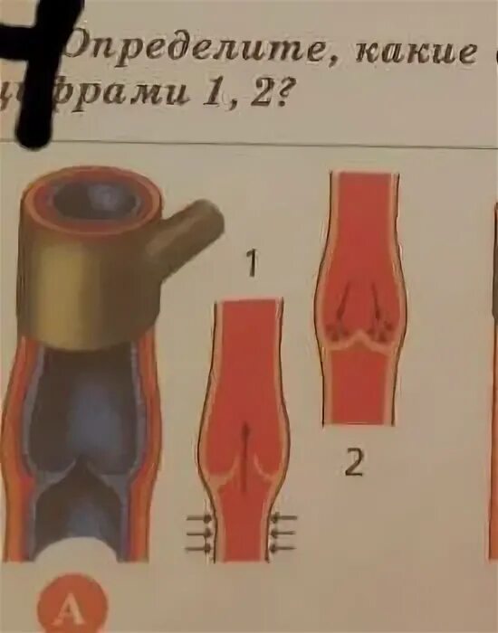 Какой сосуд поврежден. Под какой цифрой на рисунке изображены артерии?. Под какой цифрой на рисунке изображены вены?. Определите сосуды изображенные на рисунке. Какой сосуд изображён на рисунке.