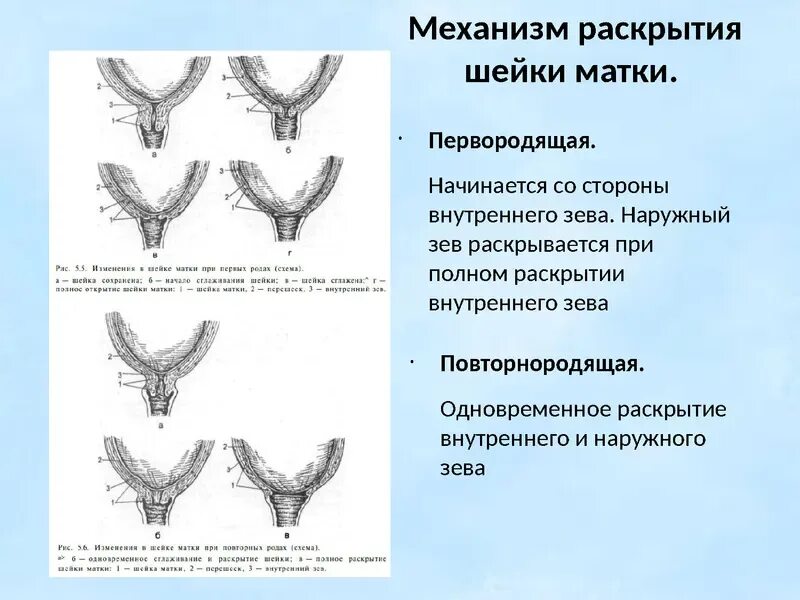 Зев т образный. Шейка матки наружный зев сомкнут. наружный зев и внутренний зев маточный. шейка матки внутренний зев и наружный зев. степень раскрытия маточного зева.