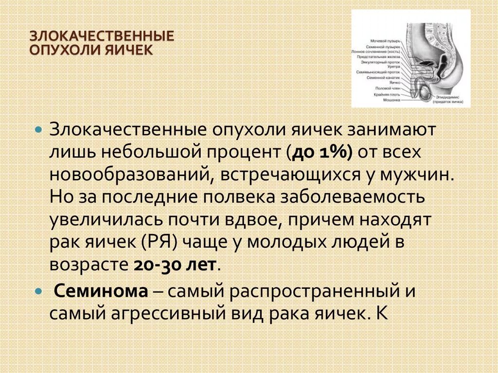 Злокачественные опухоли яичка. Опухоли яичка классификация. Новообразование на яичке. Болит тянет яичко