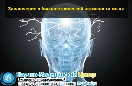 Активность мозга. Исследование мозга. Электрическая активность головного мозга. Измерение активности мозга.