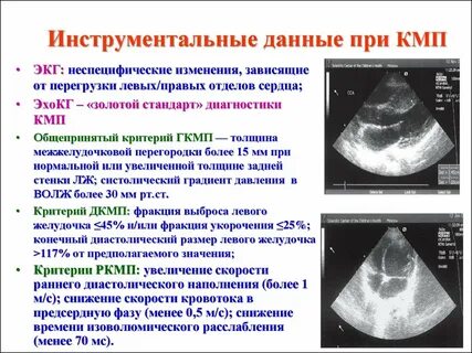 Узи сердца екатеринбург