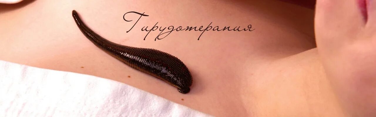 Выразить гирудотерапия эффект. Выразить гирудотерапия эффект