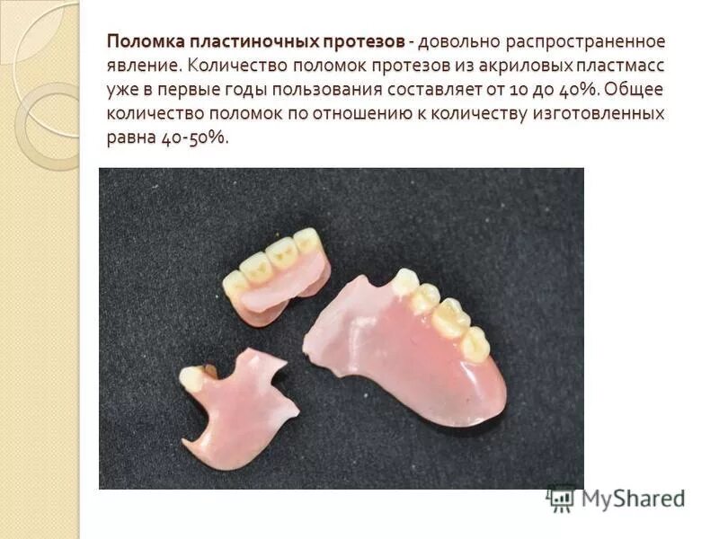 Показания к пластиночным протезам